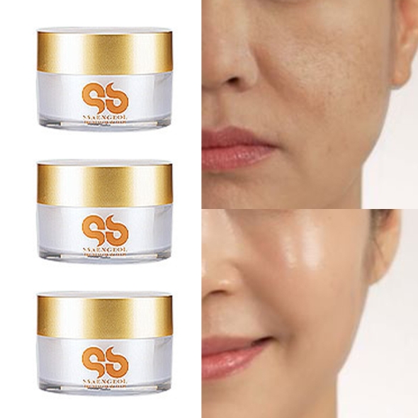 [쌩얼기미] 뿌리부터 쫙- 니들샷 MTS 율피크림 50g