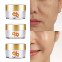 [쌩얼기미] 뿌리부터 쫙- 니들샷 MTS 율피크림 50g