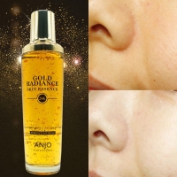 금값 오르기전에! [앙쥬] 24K 순금으로 기미리셋 에센스 150ml